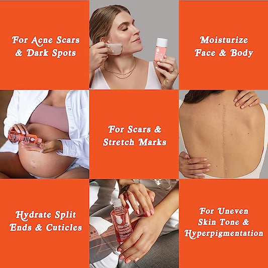 Bio Oil Skincare Oil - For Scars and Stretch Marks - 60ml