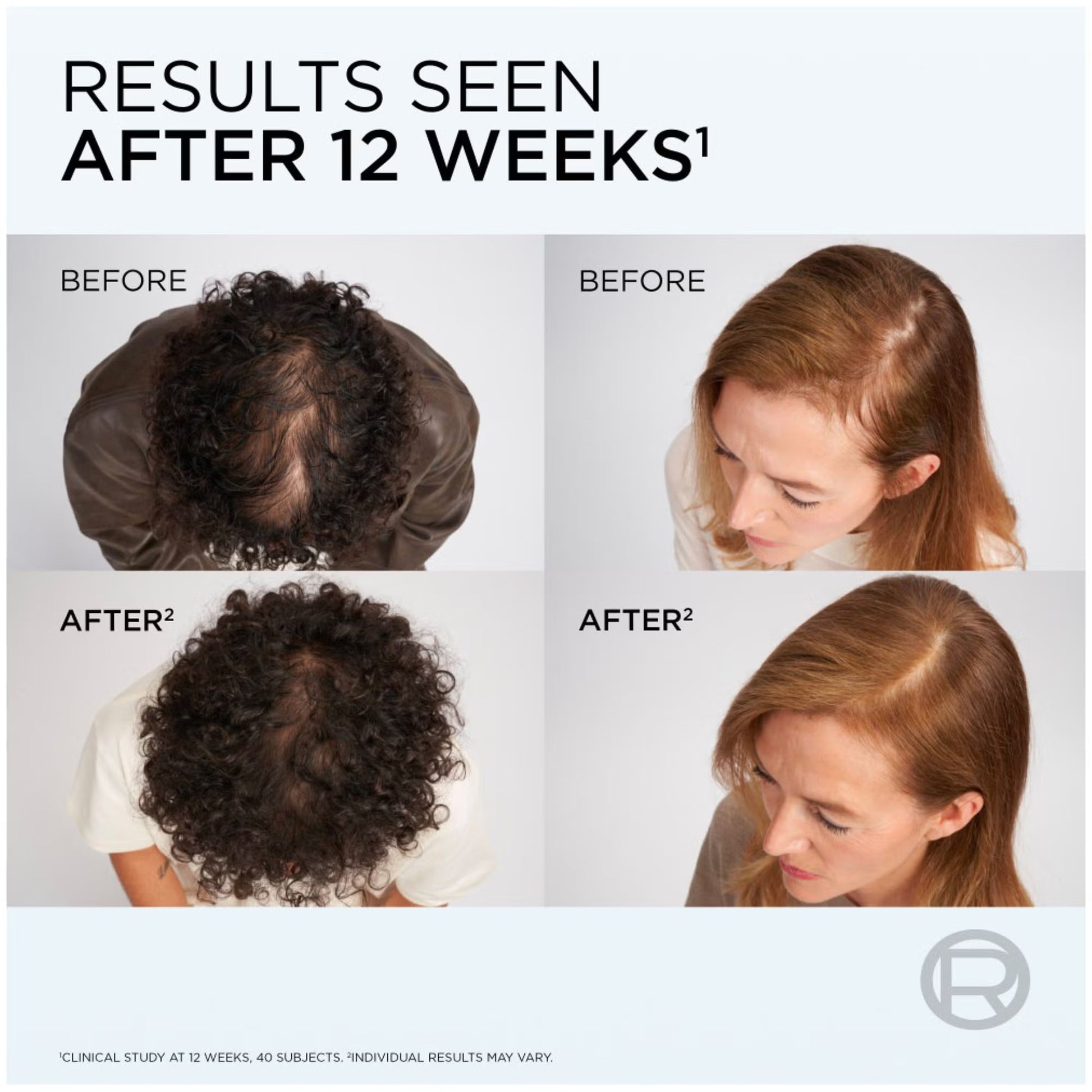 L'Oreal Elvive Growth Booster Anti-Fall Shampoo 200ml