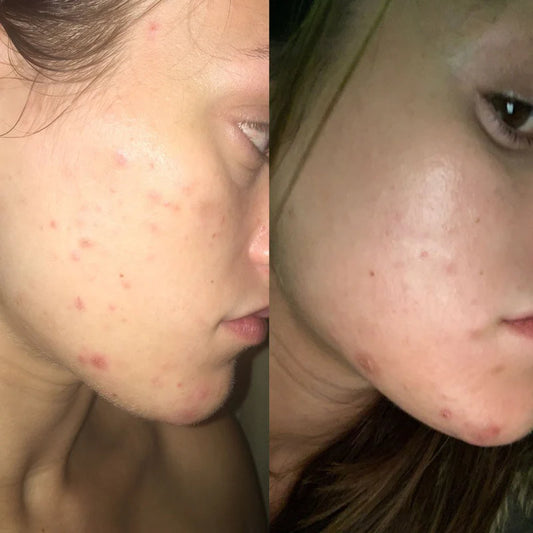 Cerave SA Lotion for Rough & Bumpy Skin 237ml