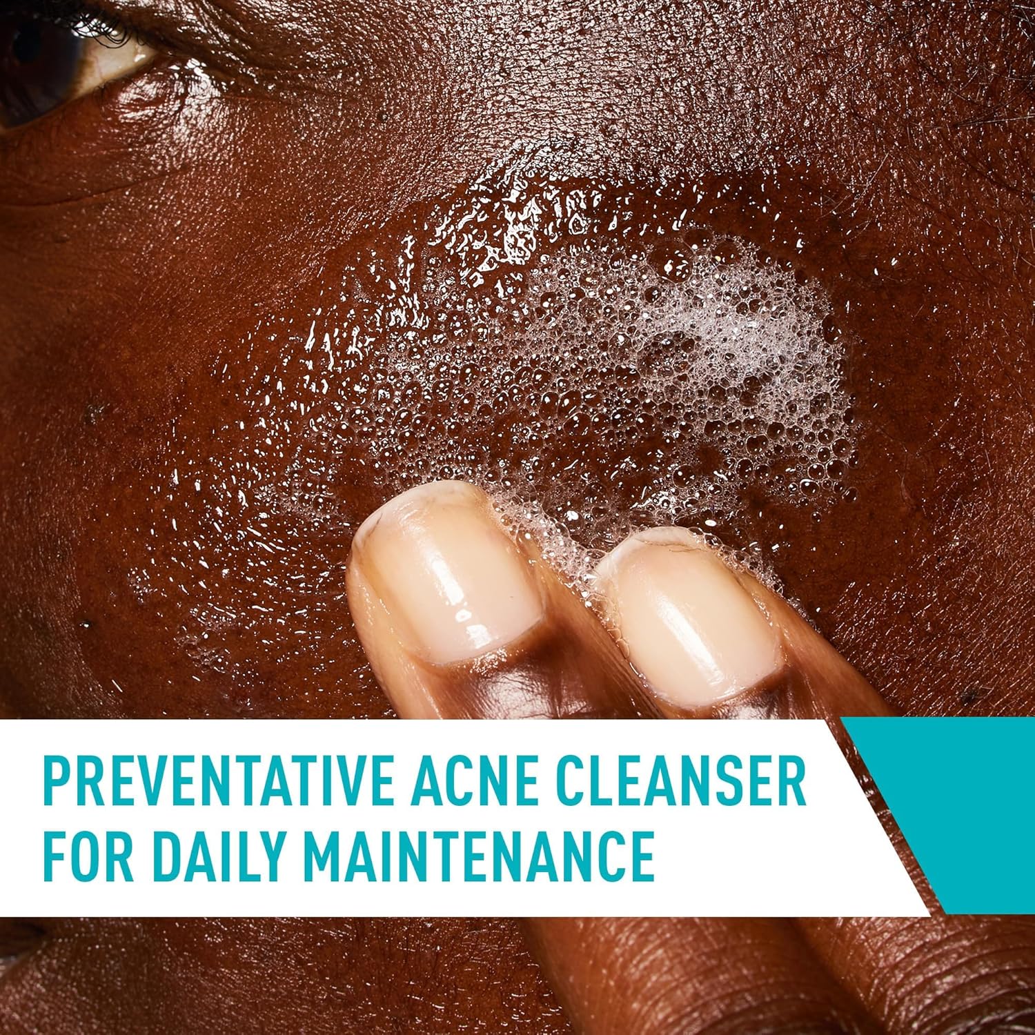 CeraVe Acne Control Cleanser with Salicylic Acid 355ml USA