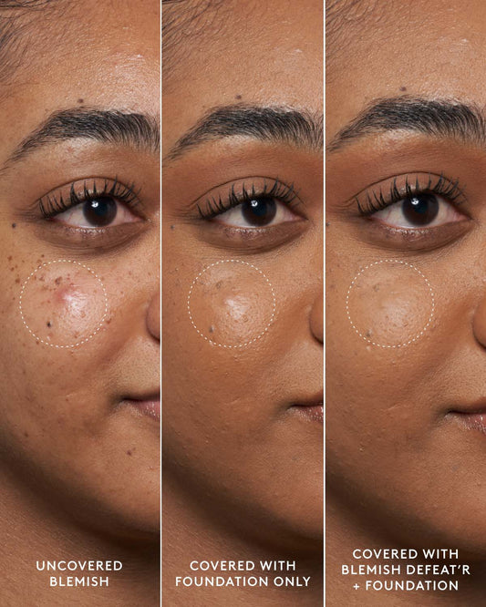 Fenty Skin Blemish Defeat'R Bha Spot Targeting Gel 15ml