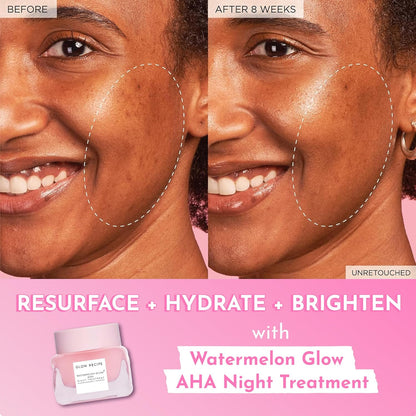 Glow Recipe Watermelon Glow AHA Night Treatment 25ml