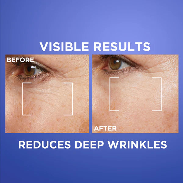 L'Oreal Revitalift Laser Pure Retinol Deep Wrinkle Night Serum 30ml