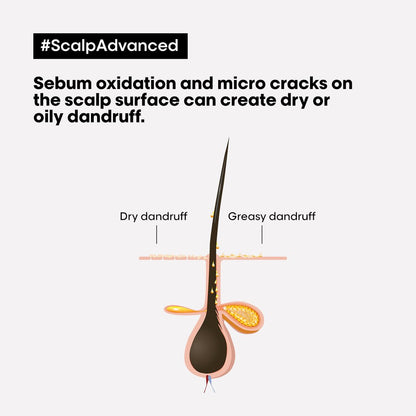 L'Oreal Scalp Advanced Anti-Dandruff Shampoo 300ml