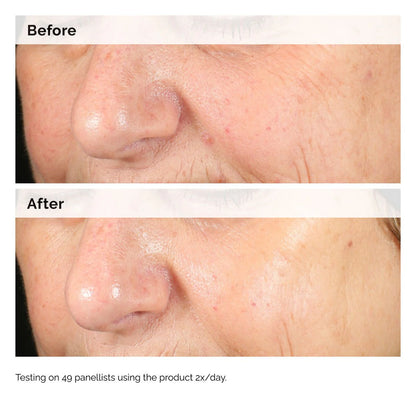 The Ordinary Alpha Arbutin 2% + HA  30ml