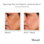 Murad Rapid Age Spot and Pigment Lightening Serum